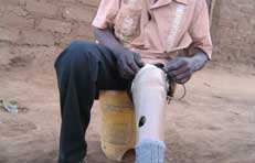 Alex sitting with lower leg