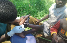 Child being treated for jiggers