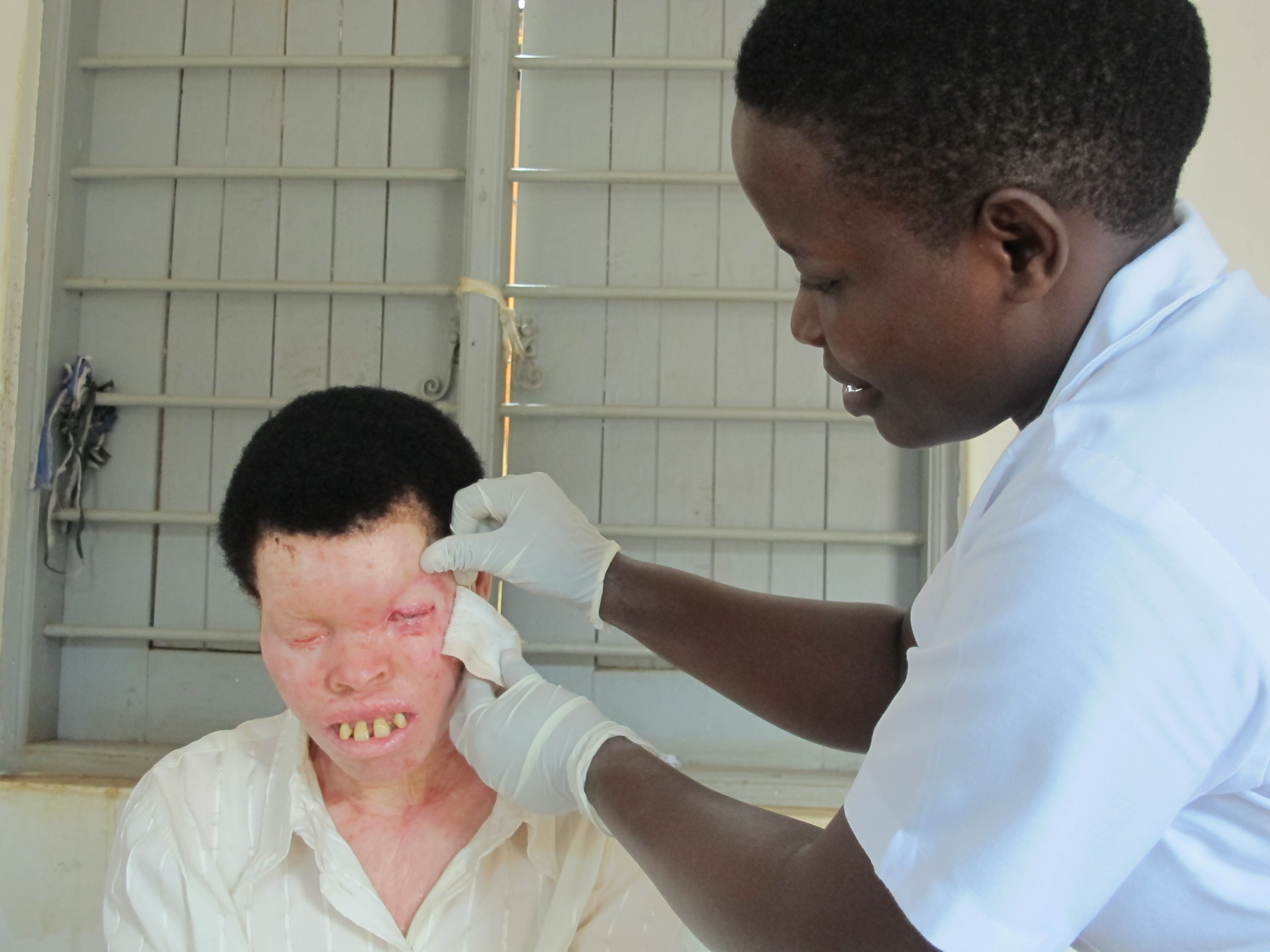 Justine after surgery